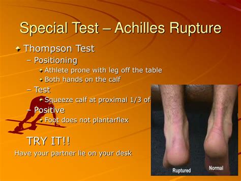 achilles tear special test|positive squeeze test achilles.